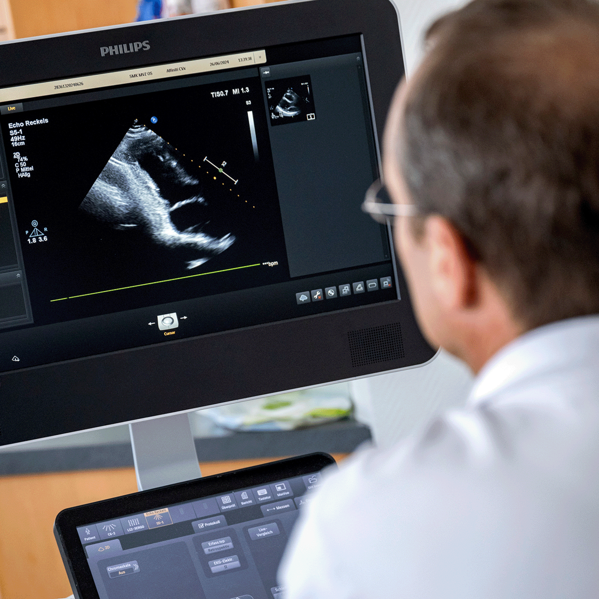 Ein Arzt betrachtet ein Ultraschallbild, um präzise Diagnosen im Bereich der Kardiologie zu stellen und Herz-Kreislauf-Erkrankungen individuell zu behandeln.